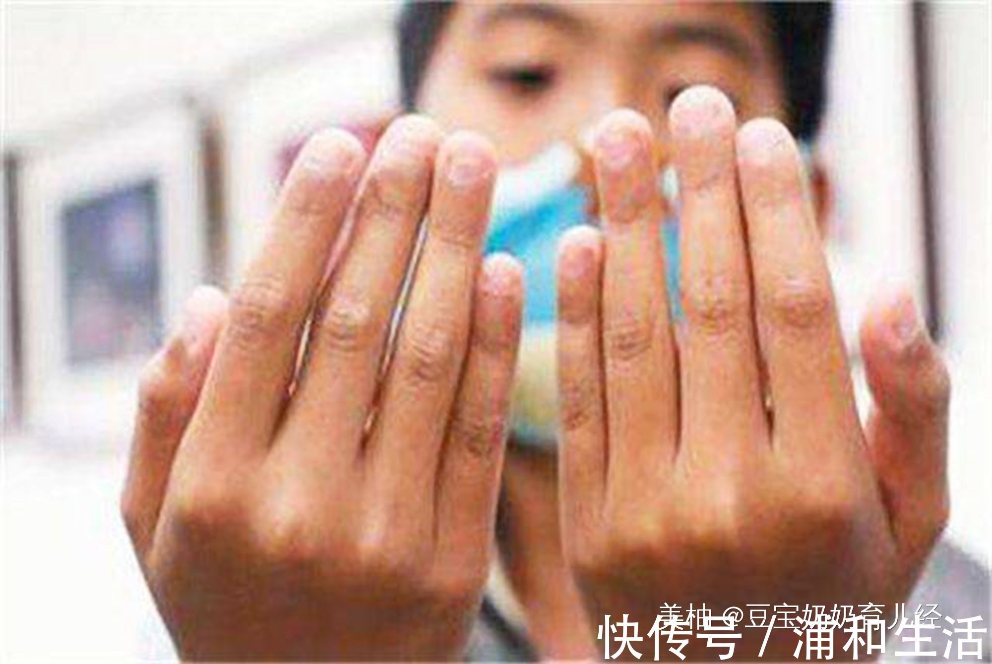 这些事|孩子咬指甲是行为习惯?错了,啃指甲吃手这些事没那么简单