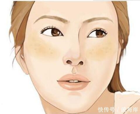 有一种难过叫“痘印”!维生素E不见效,这3个方法才靠谱!