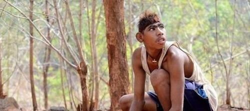 妈妈|儿子越长越像“大猩猩”,妈妈带去检查后,医生责问咋不早点来