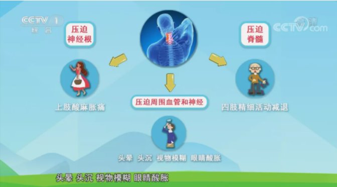 颈椎|警惕！这些不良生活习惯正在伤害你的颈椎