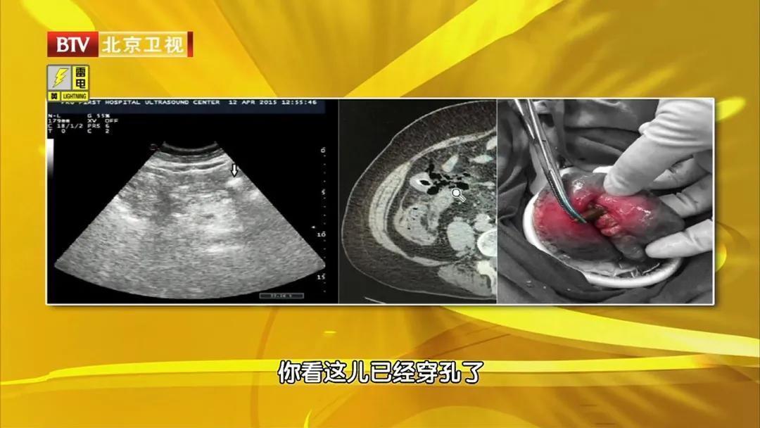 脾胃|大枣这样吃,功效翻几倍!每天吃3颗,气血足,脾胃好