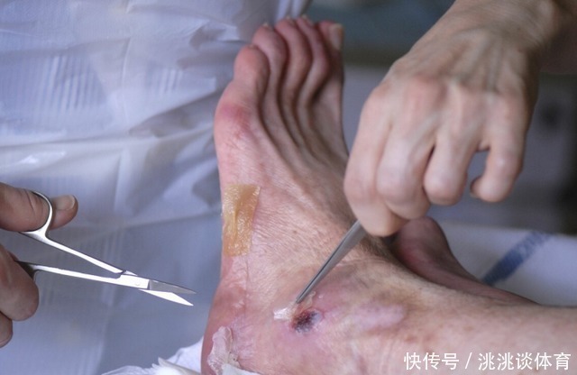 随机血糖|血糖高于多少，会出现危险？医生给出解释，让你心里有个底