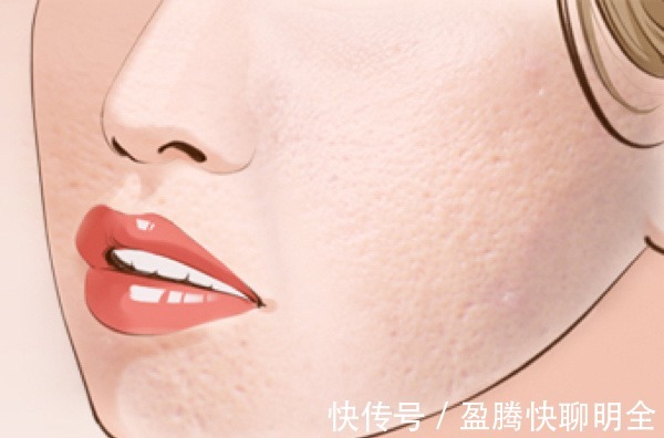 饮食习惯|男士护肤:皮肤长痘应该怎么护肤?