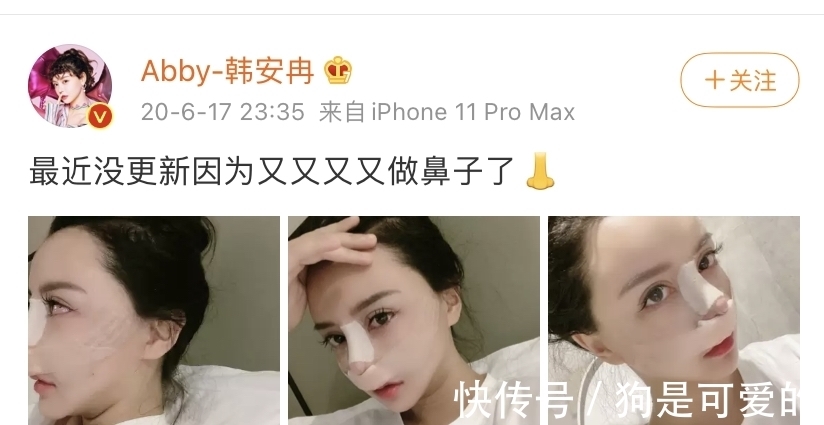 閃婚閃離|20歲生女閃婚閃離、整容成癮,《變形記》的韓安冉如今怎么樣了?