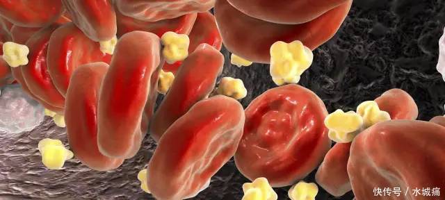 桑叶|人到中年,血液越来越黏稠,用此叶子泡水喝防血栓,高血压绕路走