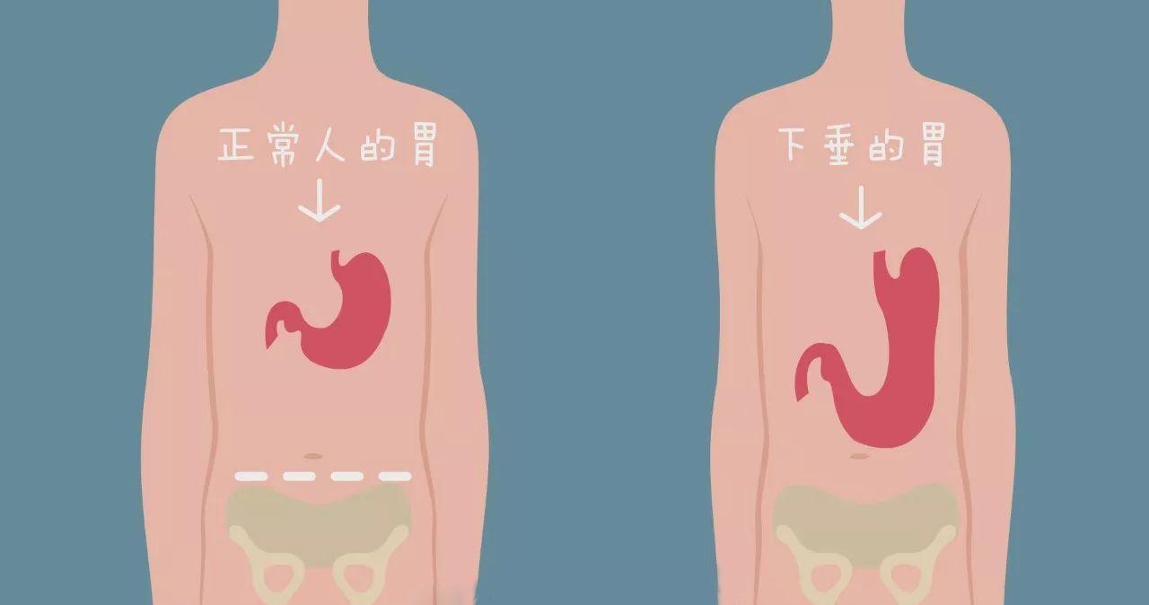 胃胀|经常胃胀,嗳气,消化不良,是脾胃虚了!中医1方,帮你补中益气