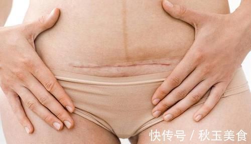 孩子|生孩子真的好害怕!自然产、剖腹产,准妈妈将如何选择?