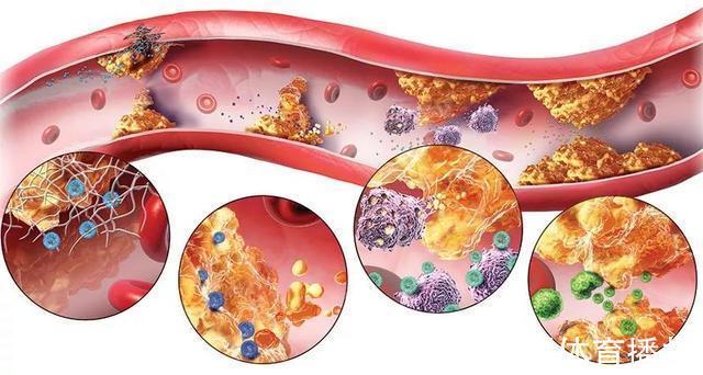 虾皮|即使骨质疏松也要补钙,但不能喝骨头汤,而是这2种真正补钙食物