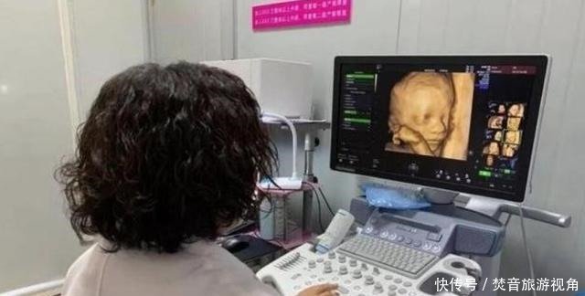 算数|“天才”胎儿走红,还在妈妈肚里就会“算数”,医生清华北大等你
