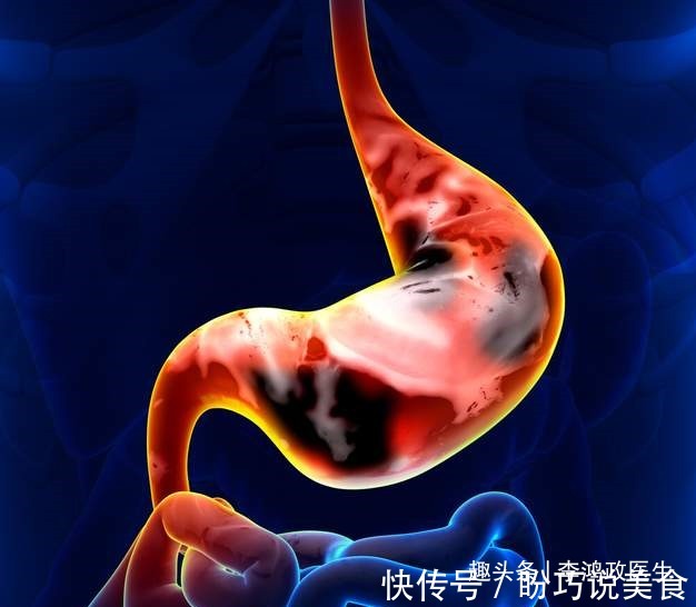 妇科医生|女子头晕半年，以为患癌症，检查结果让她觉得重获新生