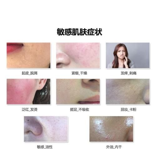 敏感肌首选这2款热门水乳，人气口碑俱佳！