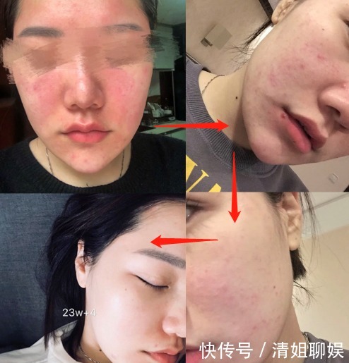 孕期|孕期护肤的正确姿势——补水保湿!盘点性价比超高的护肤王牌神器