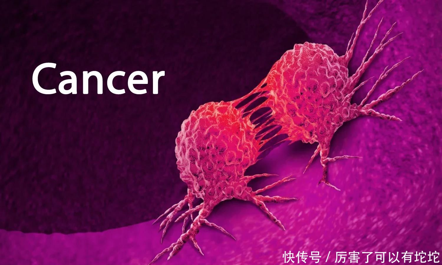 怎样才能预防癌症复发?肿瘤科医生说了大实话