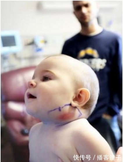 女婴|父母带着脖子突出一根东西的女婴去医院　一往外拉连医生都吓傻