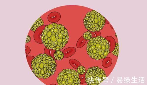 手术|癌症患者做完手术，已经把肿瘤切干净了，为何之后却还是复发了