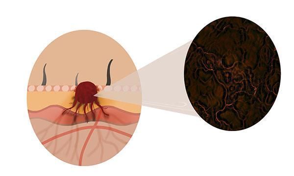 体质|拥有抗癌体质的人,都具备什么特征若你全都符合,身体不会太差