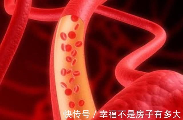 恢复|我的高血压是如何恢复正常的没用降压药,只做了这样一件事