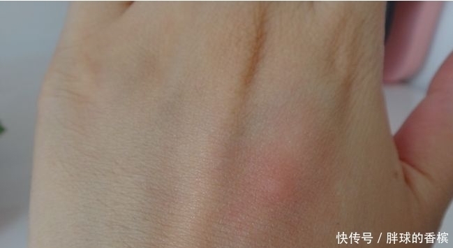 人可以说|血糖高不高先看手,若没有3个“表现”恭喜,你的血糖很稳定
