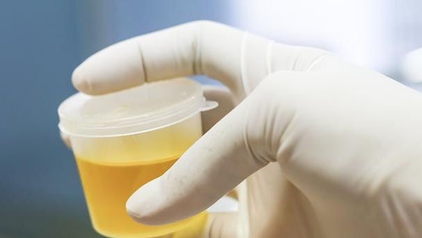 男性朋友|男性晨起“第一次小便”，若没有3个表现，偷乐吧，肾脏很强壮