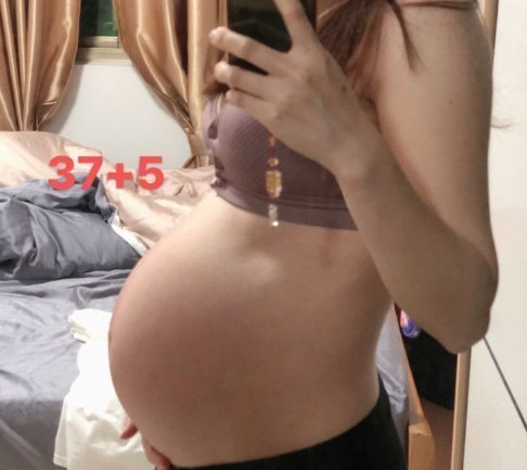 琳琳|“胎儿都有唇裂了，还成天抱手机”胎儿畸形受什么原因影响