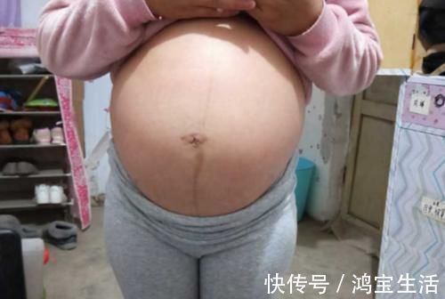 中期|准妈妈进入孕中期，4个部位逐渐“膨胀”，该如何应对身体变化？