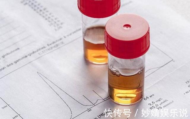 脸色|为何越来越多人得尿毒症？当身上3处亮起红灯，要留神