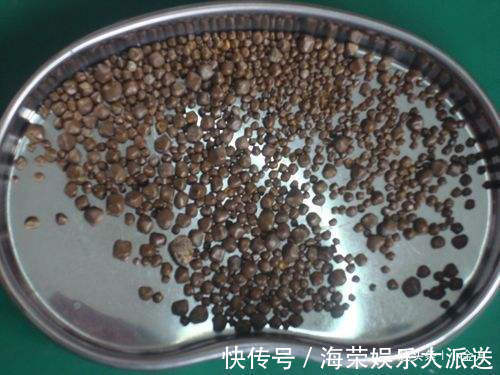 血管|中药材“郁金”打通血管里的瘀和堵,是金子总会发光!