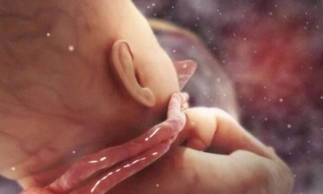 小薇|8个月孕妈做产检,医生看到画面都笑了,孕妈:出生看我不收拾你