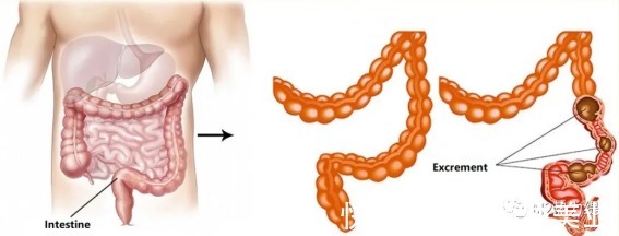 肠道运动|「生命养护」,如何调理亚健康、便秘!