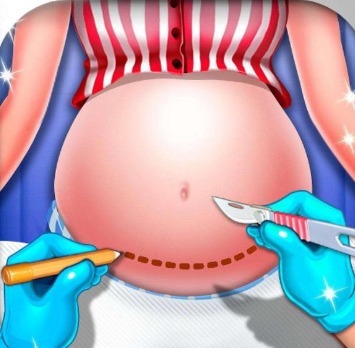 导尿管|剖腹产最痛是什么时候一共有三痛,女人太辛苦了!感谢妈妈