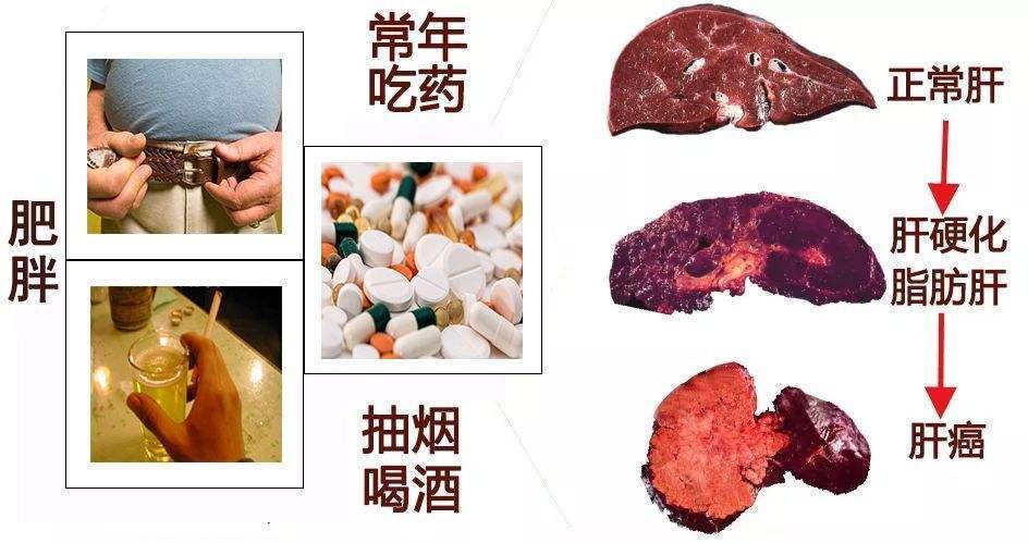 四大名补|送给癌症患者们的“四大名补”食疗方,这才是正确的抗癌方式