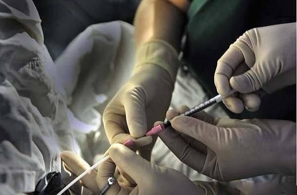 胚胎|揭秘试管婴儿全过程(附图),看完后心疼女性一万遍