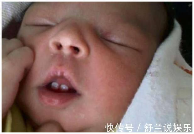 钙片|结婚6年终于怀孕,孩子出生有三颗牙,看完把医生吓了一跳!