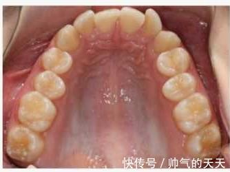 步态|担心信息泄露你需要注意的不只是指纹而已！