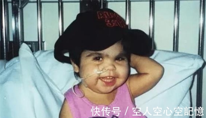 早夭|美国女孩出生患美人鱼症，喜欢在水里，生存十年创造医学奇迹