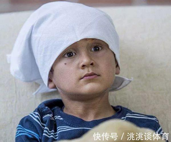 催熟|超市里4种水果,含有大量甲醛,诱发白血病,不要再给小孩吃了