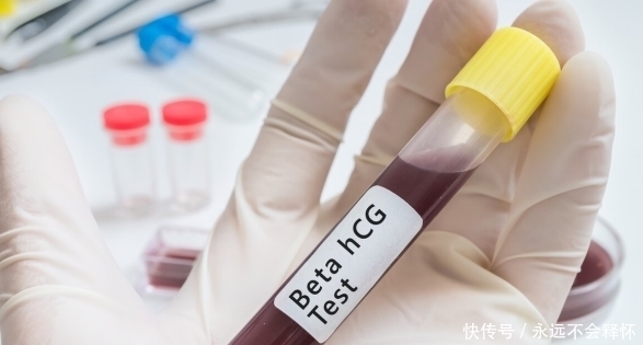 脑梗怎么办?内科医生提醒:做好3件事,脑梗慢慢好