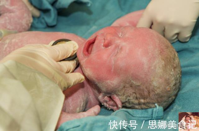 小雪人|妻子生下“小雪人”宝宝,陪产丈夫看到后连忙解释:和我没关系