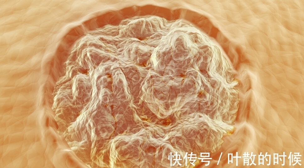 同居|“糟蹋”子宫的4个行为，吃辛辣不算什么，第一个很多人“明知故犯”