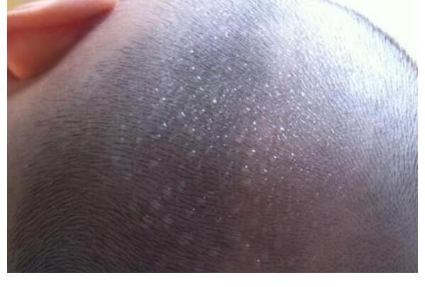 圆圆|5岁男孩咳嗽不停，查出脾衰，医生：这3种食物吃一次1周不消化