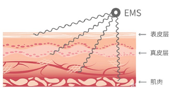 细纹|少女感你也可以：去除法令纹的方法，只说这一次