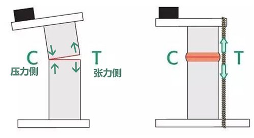 牵拉力|颧骨内推后,面部皮肤一定会下垂吗？看完秒懂