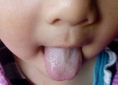 孩子|3种饭“偷走”孩子身高,父母还塞给孩子,儿科主任:无知父母害了娃