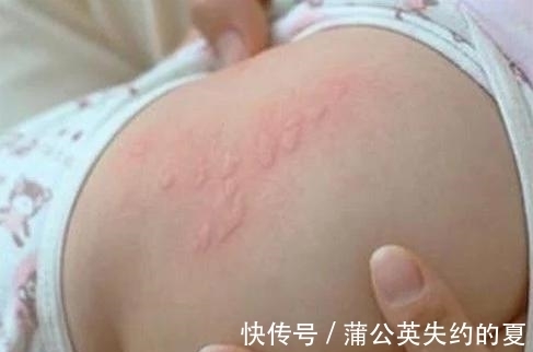 宝宝|奇闻:宝宝全身起小疙瘩,妈妈翻起床垫,看到画面,女子欲吐