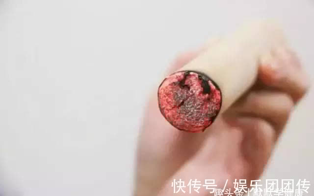 桂圆肉|伏天是补阳、祛痰湿的好时机，这3招，阳虚、痰湿重的人别错过！