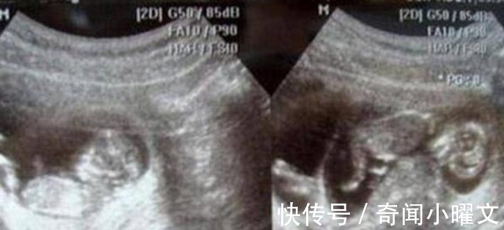 产妇|国外48岁高龄产妇怀上龙凤胎，可宝宝出生后，她却觉得天要塌了