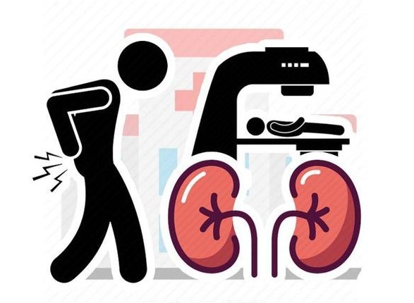 癌前病变|肾癌比较偏爱的人,多半有四个共同点,若你一个不占,值得高兴