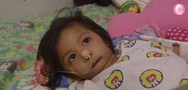 手术|女孩一出生就没有手脚，没有嘴，3岁才开口吃到第一口饭