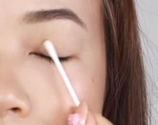 化妆品|割双眼皮疤痕增生怎么办 不想留疤一定要看!