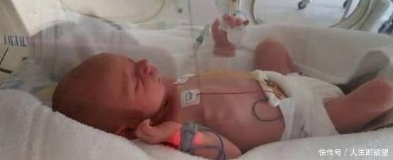 女子|女子因胃痛去医院检查却被告知已怀孕,不到一小时生了个娃